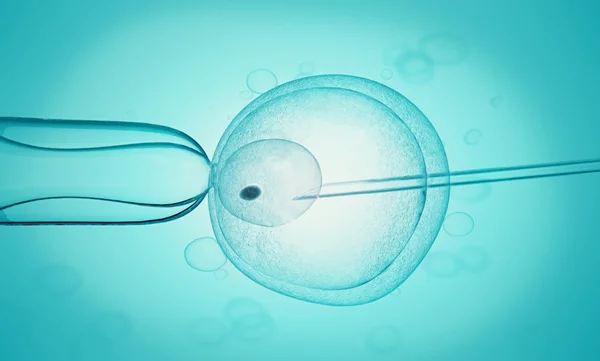 IUI