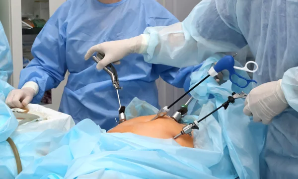 Laparoscopic Hysterectomy