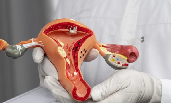 Management of Uterine Ovarian, and Cervical Cancers Laparoscopic and Open Surgical